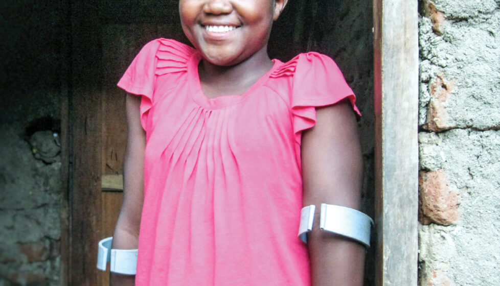 a young girl stands in a door way with crutches smiling